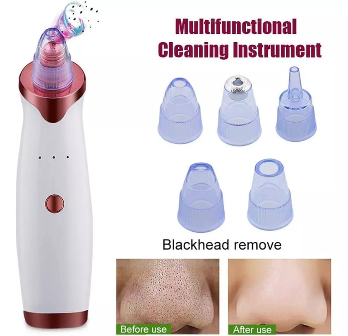 Limpiador Facial Máquina Extractora De Puntos Negros Acne