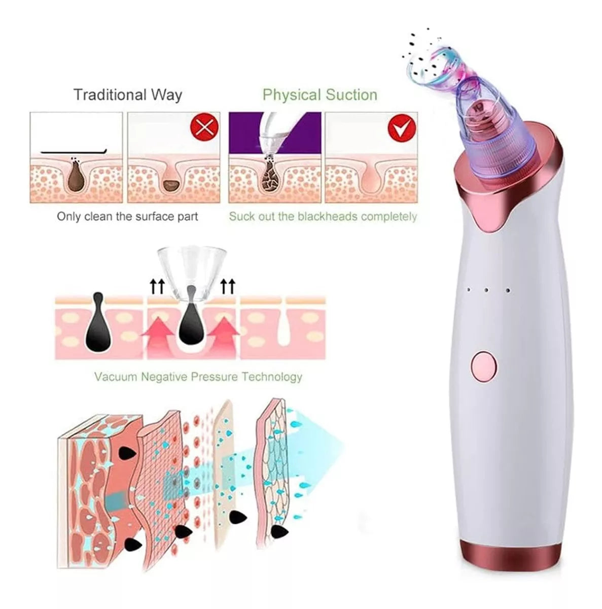 Limpiador Facial Máquina Extractora De Puntos Negros Acne